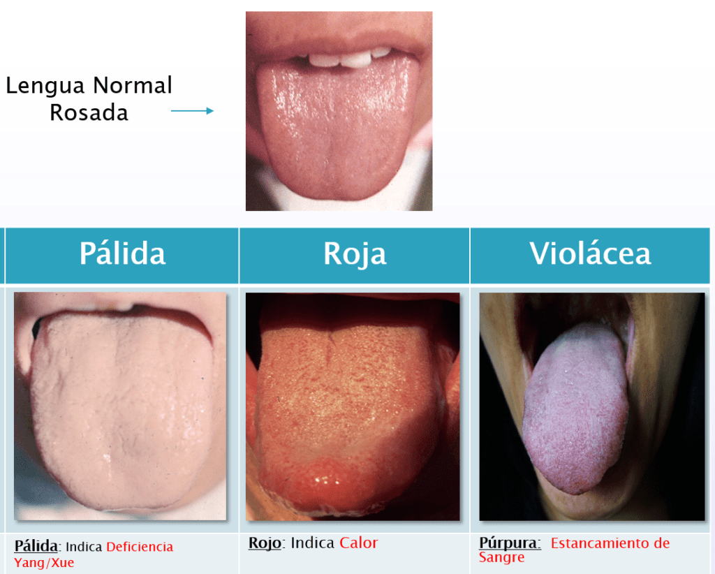 La Observación en MTC y el color de la lengua