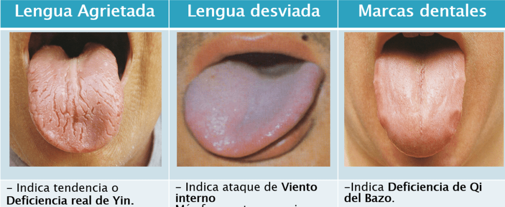 La Observación en MTC y la forma de la lengua